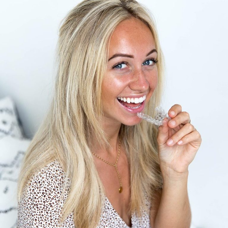 Exploring the Unseen Benefits of Invisalign for Overall Wellbeing