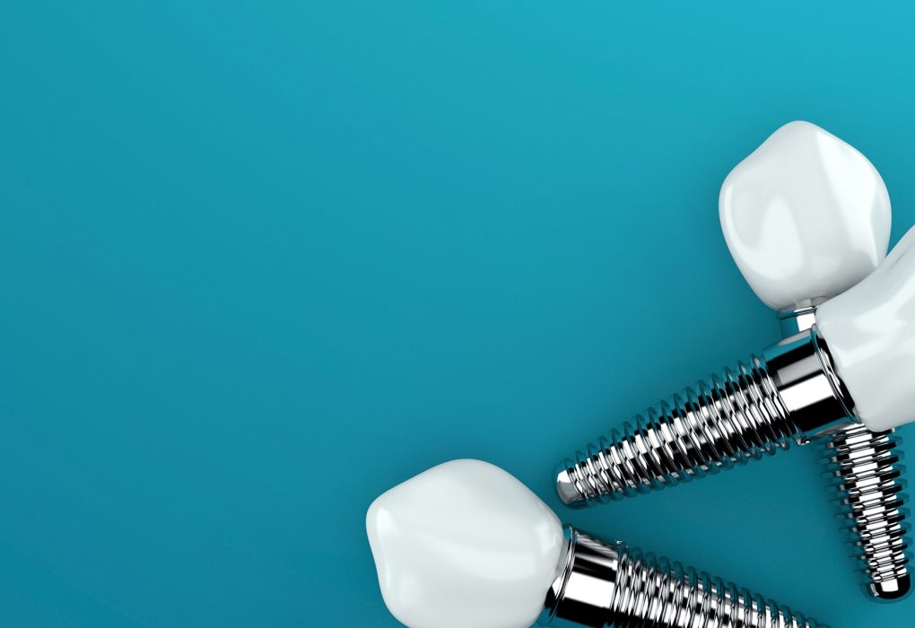 How Hormonal Changes Throughout Life Influence Dental Implant Osseointegration