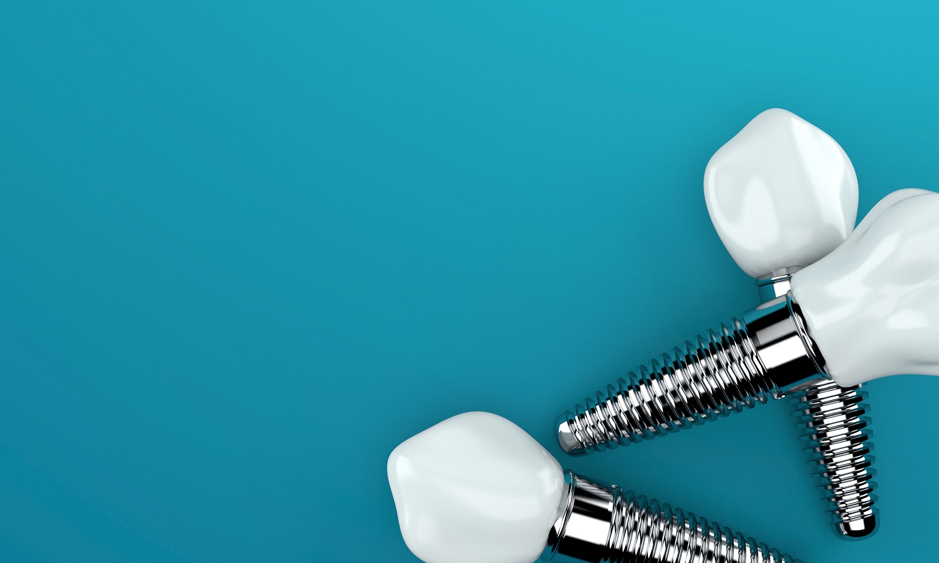 How Hormonal Changes Throughout Life Influence Dental Implant Osseointegration